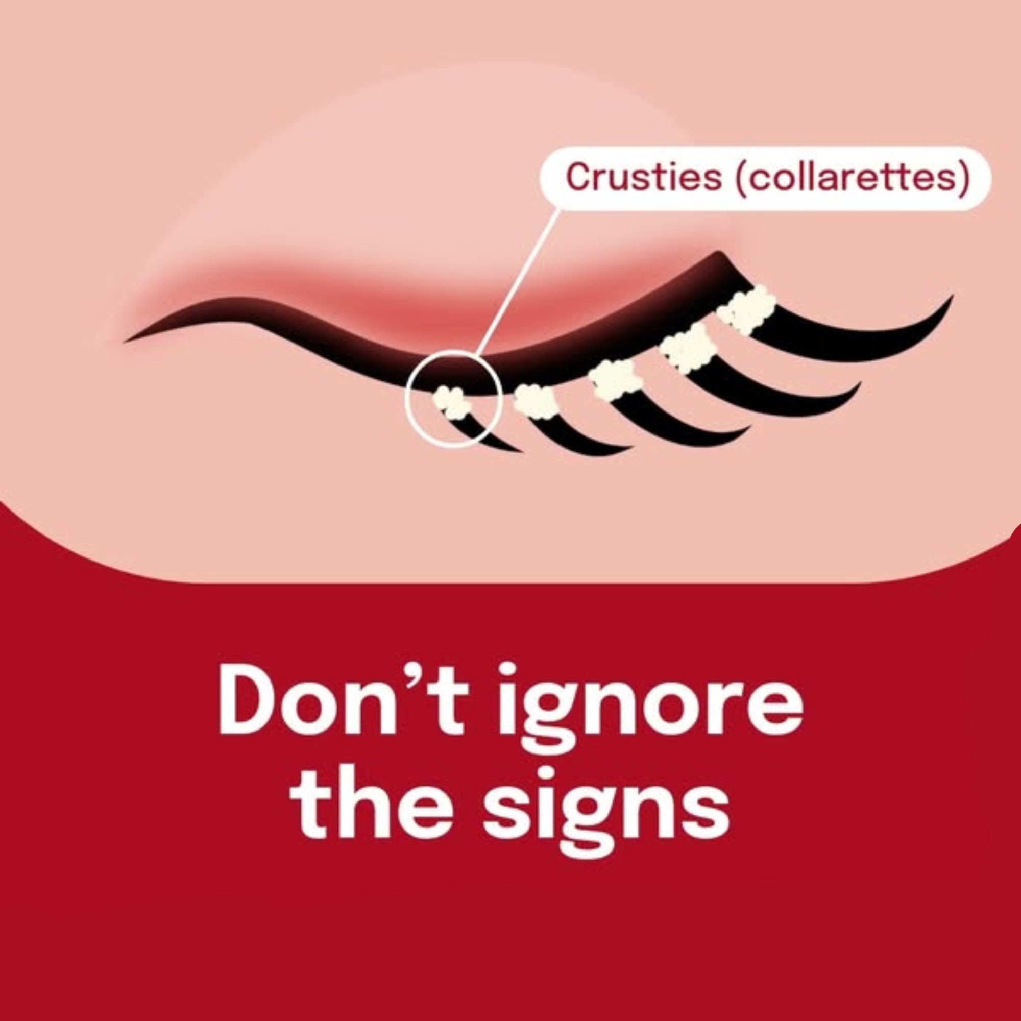 Original ad, flat illustration of an eye